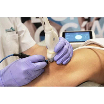 Physio Invasiva 2.0 - Urządzenie do wykonywania igłowej przezskórnej elektrolizy i neuromodulacji