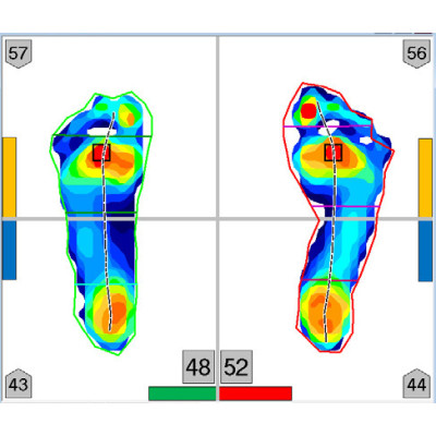 MobileMat™ – mata do pomiaru ciśnienia dla analizy biomechanicznej