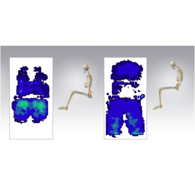 Tekscan ConforMat